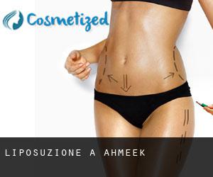 Liposuzione a Ahmeek