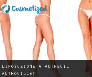 Liposuzione a Autheuil-Authouillet