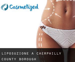 Liposuzione a Caerphilly (County Borough)