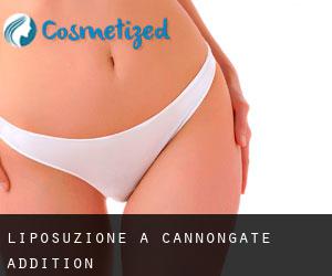 Liposuzione a Cannongate Addition