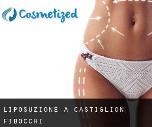 Liposuzione a Castiglion Fibocchi