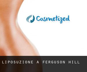 Liposuzione a Ferguson Hill