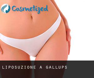 Liposuzione a Gallups