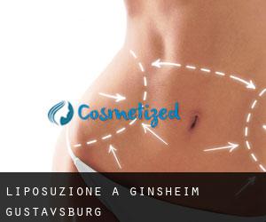 Liposuzione a Ginsheim-Gustavsburg