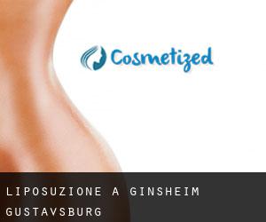 Liposuzione a Ginsheim-Gustavsburg
