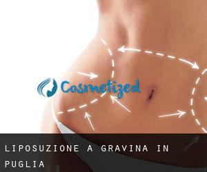 Liposuzione a Gravina in Puglia