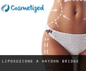 Liposuzione a Haydon Bridge