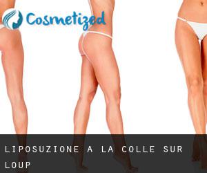 Liposuzione a La Colle-sur-Loup