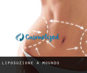 Liposuzione a Mounds