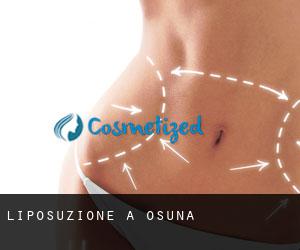 Liposuzione a Osuna