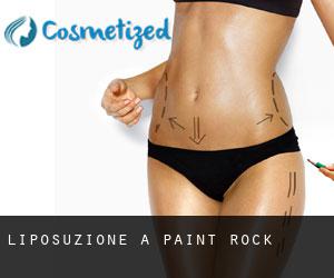 Liposuzione a Paint Rock