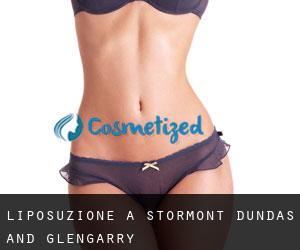 Liposuzione a Stormont, Dundas and Glengarry