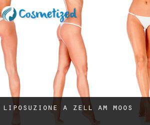 Liposuzione a Zell am Moos