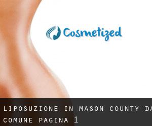 Liposuzione in Mason County da comune - pagina 1