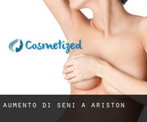 Aumento di seni a Ariston