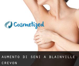 Aumento di seni a Blainville-Crevon