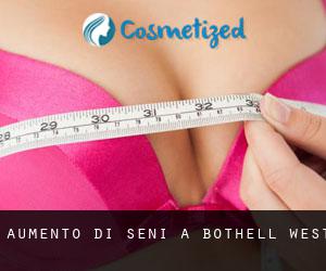 Aumento di seni a Bothell West