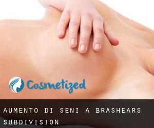 Aumento di seni a Brashears Subdivision