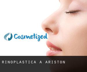 Rinoplastica a Ariston