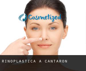 Rinoplastica a Cantaron