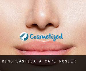 Rinoplastica a Cape Rosier