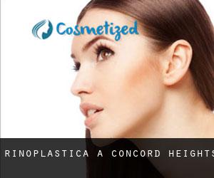 Rinoplastica a Concord Heights