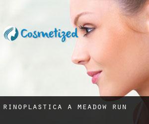 Rinoplastica a Meadow Run