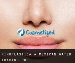 Rinoplastica a Mexican Water Trading Post