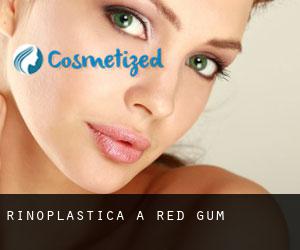 Rinoplastica a Red Gum