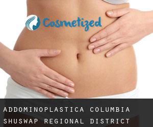 Addominoplastica Columbia-Shuswap Regional District