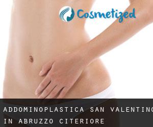 Addominoplastica San Valentino in Abruzzo Citeriore