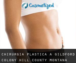 chirurgia plastica a Gildford Colony (Hill County, Montana)