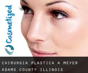 chirurgia plastica a Meyer (Adams County, Illinois)